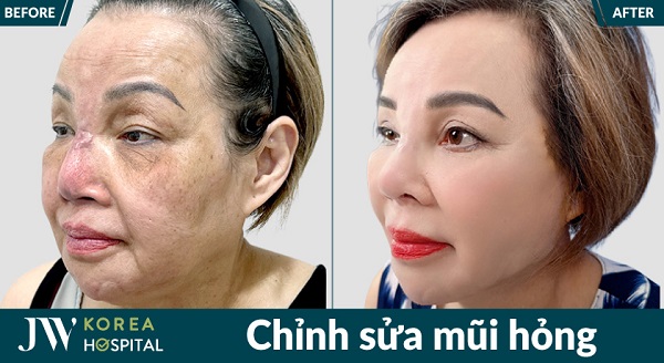 danh-sach-dia-chi-sua-mui-hong-o-tphcm-uy-tin-bac-si-gioi-nen-tham-khao-2