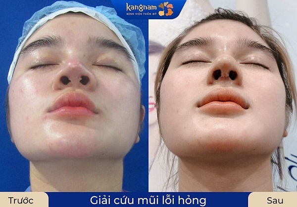 danh-sach-dia-chi-sua-mui-hong-o-tphcm-uy-tin-bac-si-gioi-nen-tham-khao-3