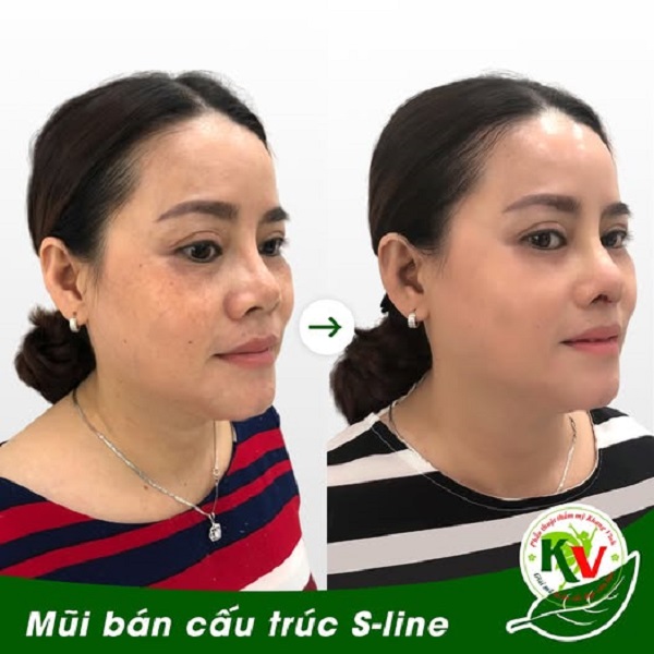 danh-sach-dia-chi-sua-mui-hong-o-tphcm-uy-tin-bac-si-gioi-nen-tham-khao-4