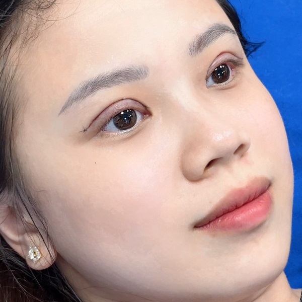 danh-sach-dia-chi-cat-mi-dep-tai-tp-hcm-uy-tin-bac-si-cat-mi-gioi-nhat-1