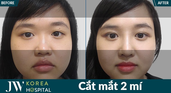 danh-sach-dia-chi-cat-mi-dep-tai-tp-hcm-uy-tin-bac-si-cat-mi-gioi-nhat-2