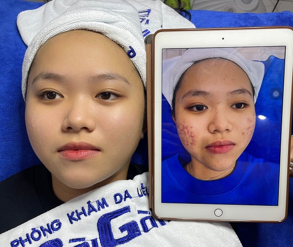 danh-sach-dia-chi-kham-da-lieu-tai-dong-nai-bien-hoa-uy-tin-3