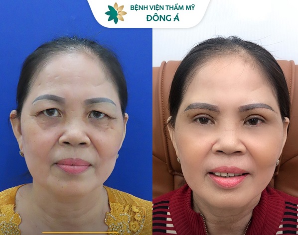 danh-sach-dia-chi-nang-cung-chan-may-uy-tin-tai-tp-hcm-dep-an-toan-nhat-4