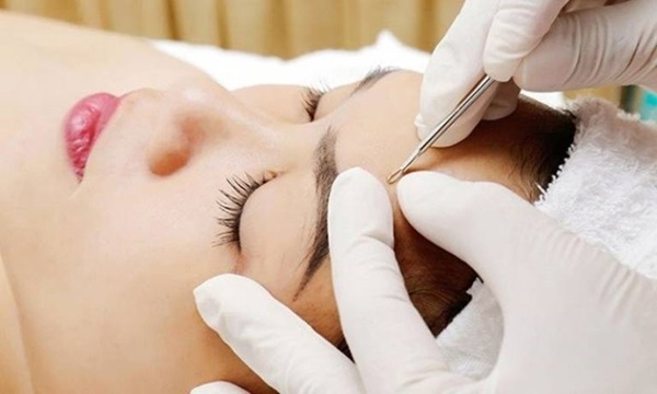Kỹ thuật lấy nhân mụn đúng cách kết hợp dụng cụ vô khuẩn giúp hạn chế đau, giảm tổn thương da và hỗ trợ da phục hồi tốt hơn sau nặn mụn.