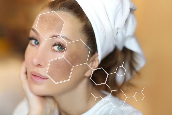 Nám, tàn nhang và đốm nâu khiến làn da kém đều màu, cần được chăm sóc đúng cách tại spa uy tín.