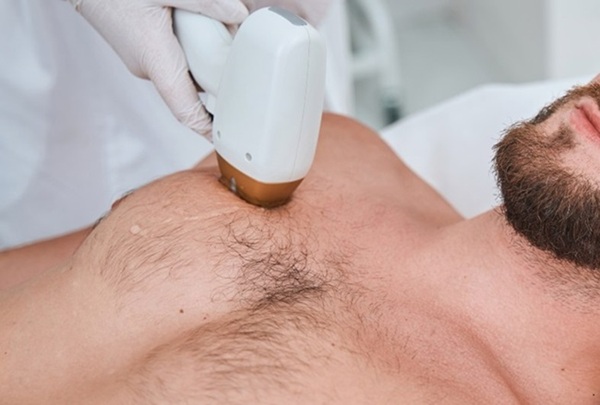 Midu Spa ứng dụng công nghệ triệt lông hiện đại, hỗ trợ làm lông mọc chậm và thưa dần theo liệu trình