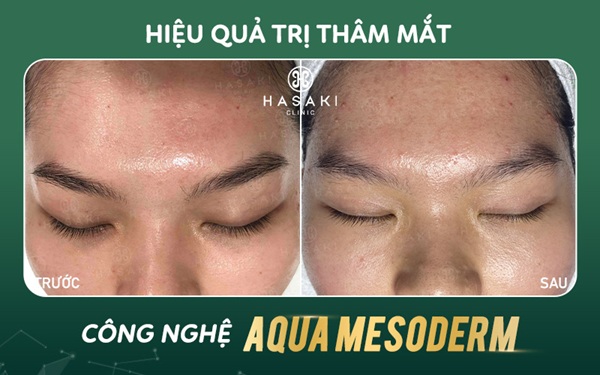 Hasaki Clinic – Phù hợp người muốn đối chiếu giá từng dịch vụ