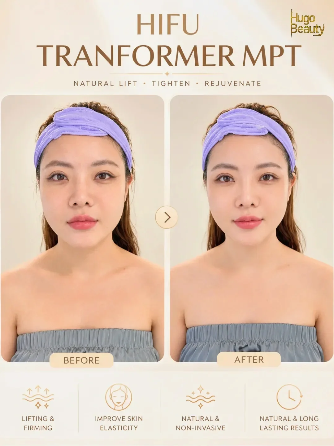 HIFU Ultraformer MPT trẻ hóa da tại Hugo Beauty Phú Nhuận