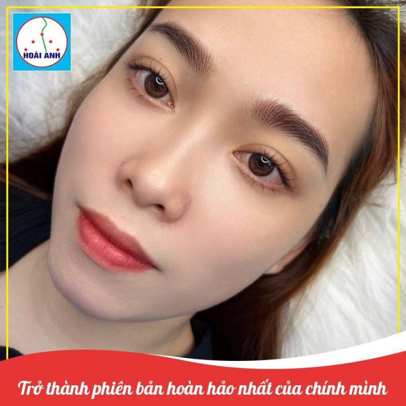 Kết quả thẩm mỹ chân mày tại Thẩm mỹ viện Hoài Anh.