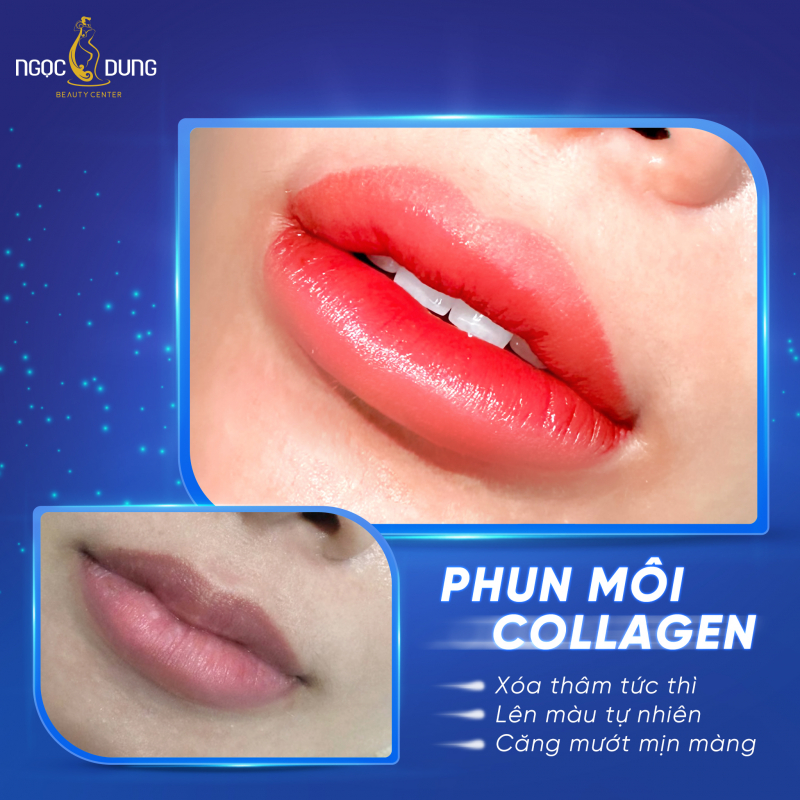 Phun môi tại Thẩm mỹ viện Ngọc Dung Quận 1