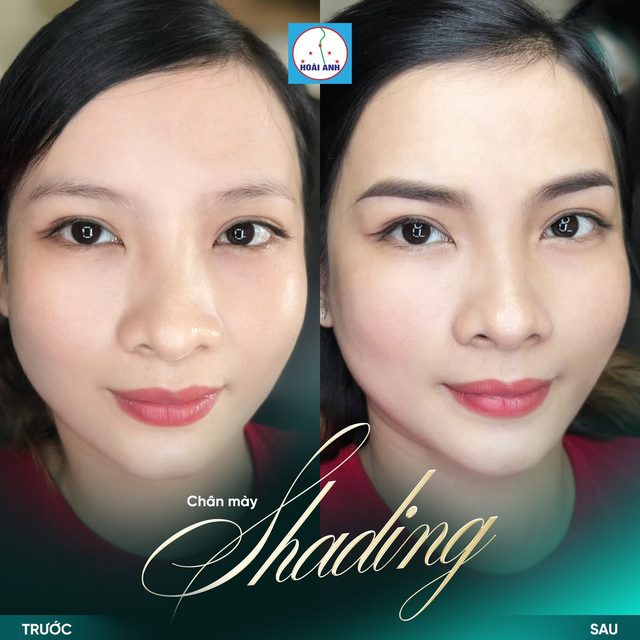 Thẩm mỹ viện Hoài Anh phun mày Shading tại Quận 1