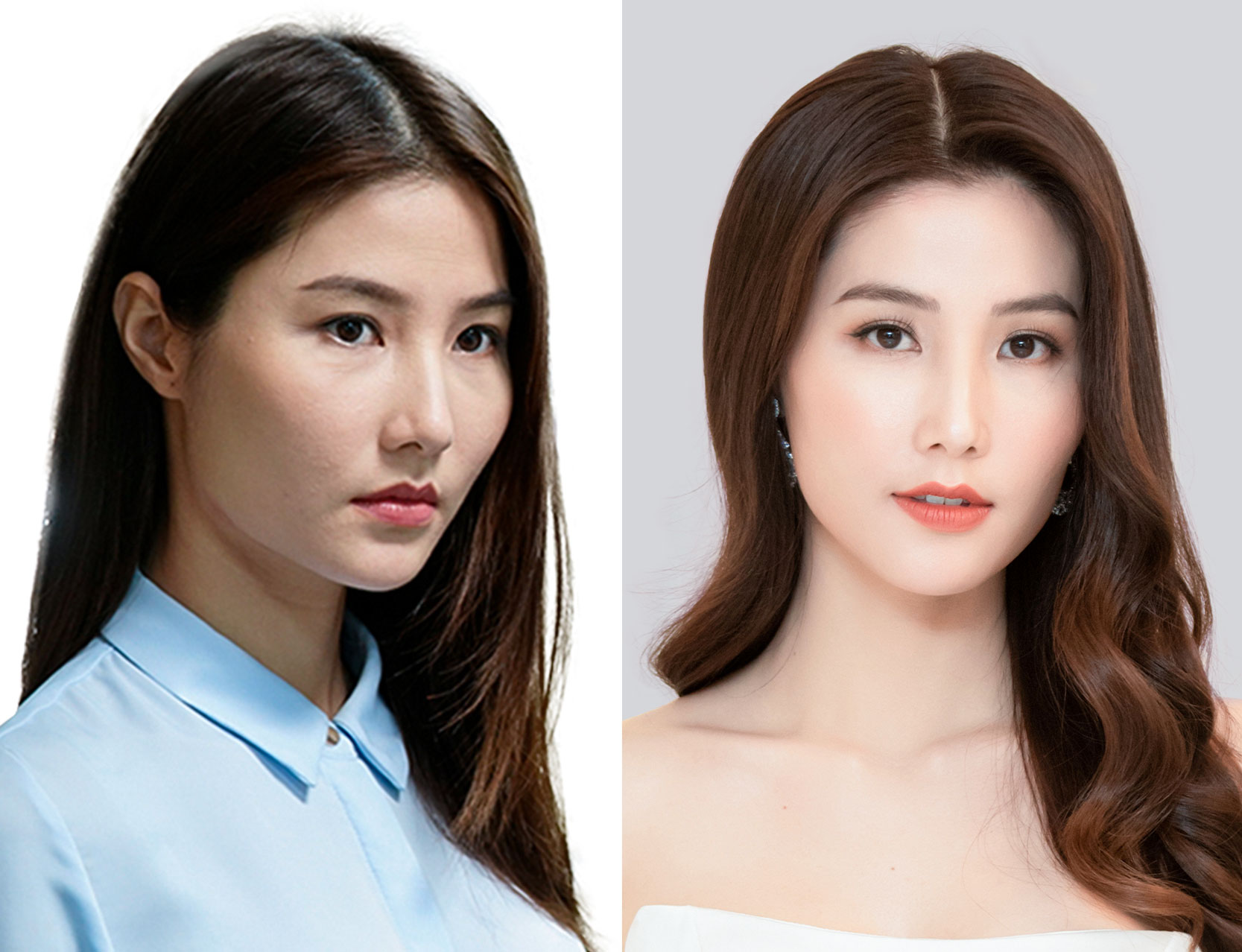Saigon Smile Medical - dịch vụ tắm trắng toàn thân Yuki Onna