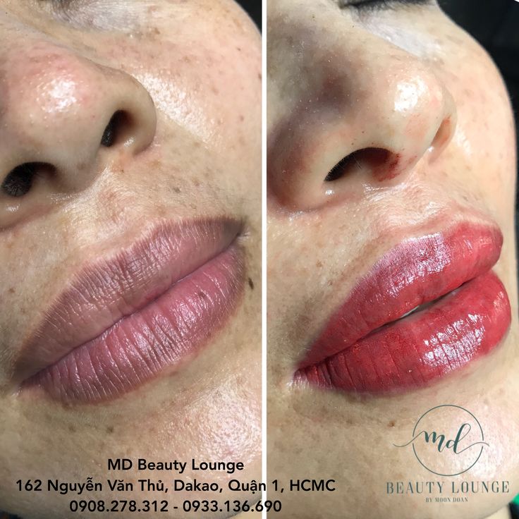 Kết quả phun môi tại MD Beauty Lounge Quận 1