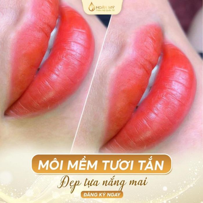 Thẩm Mỹ Quốc Tế Hoàn Mỹ - phun môi thẩm mỹ Quận 9