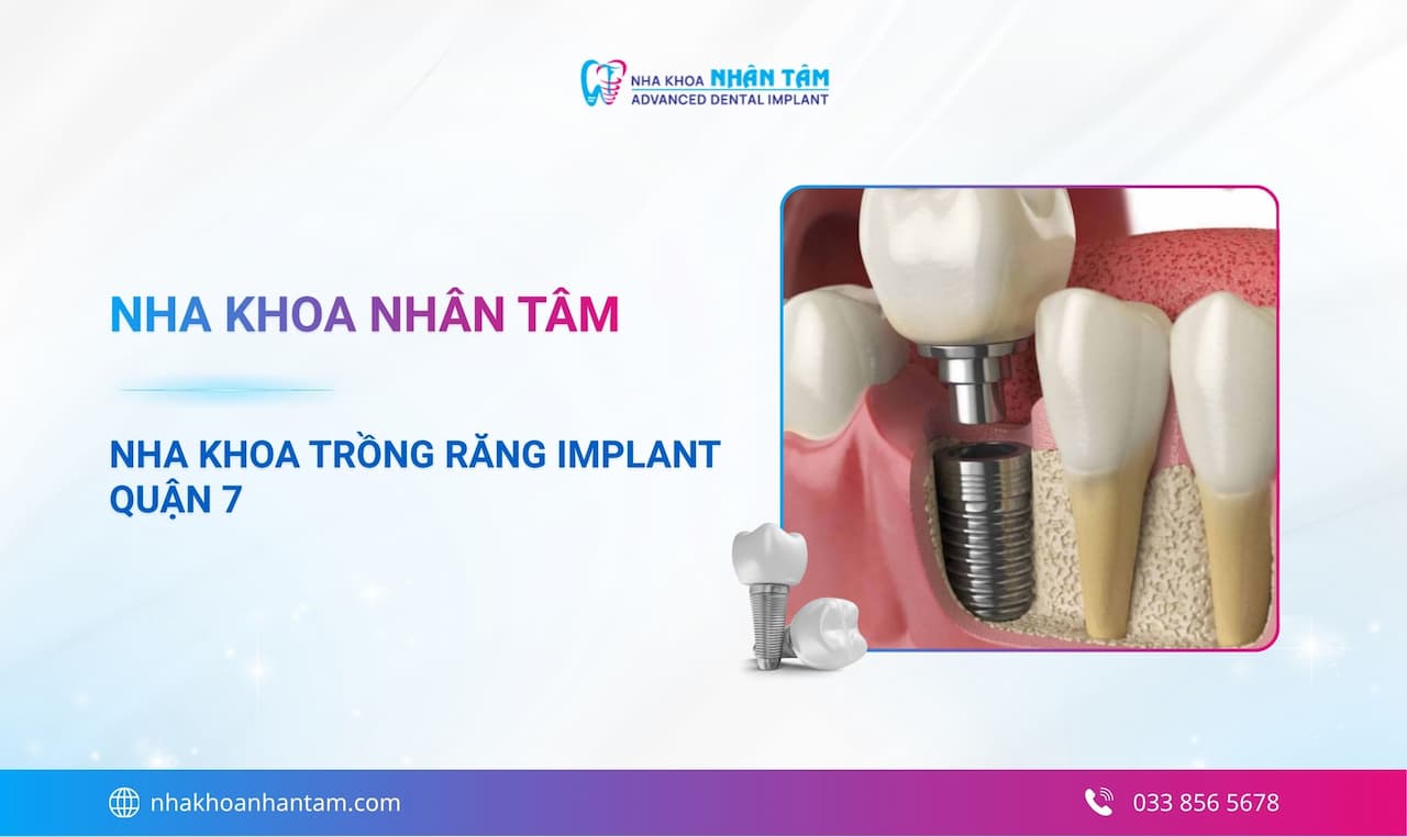 Nha khoa Nhân Tâm Quận 7 cấy ghép Implant