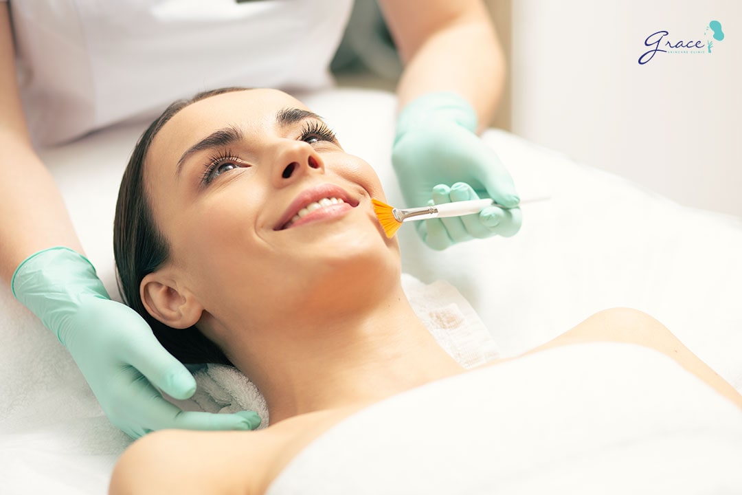 Grace Skincare Clinic - chemical peel Quận 1