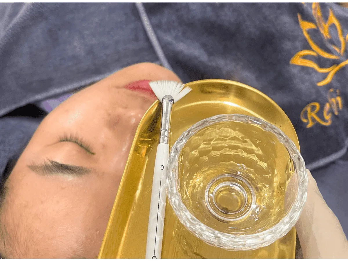 Rebi Beauty Tân Bình - dịch vụ Chemical Peel
