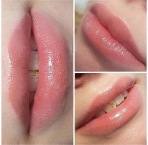 Địa chỉ phun môi Quận 9 - Thẩm Mỹ Nắng Mai