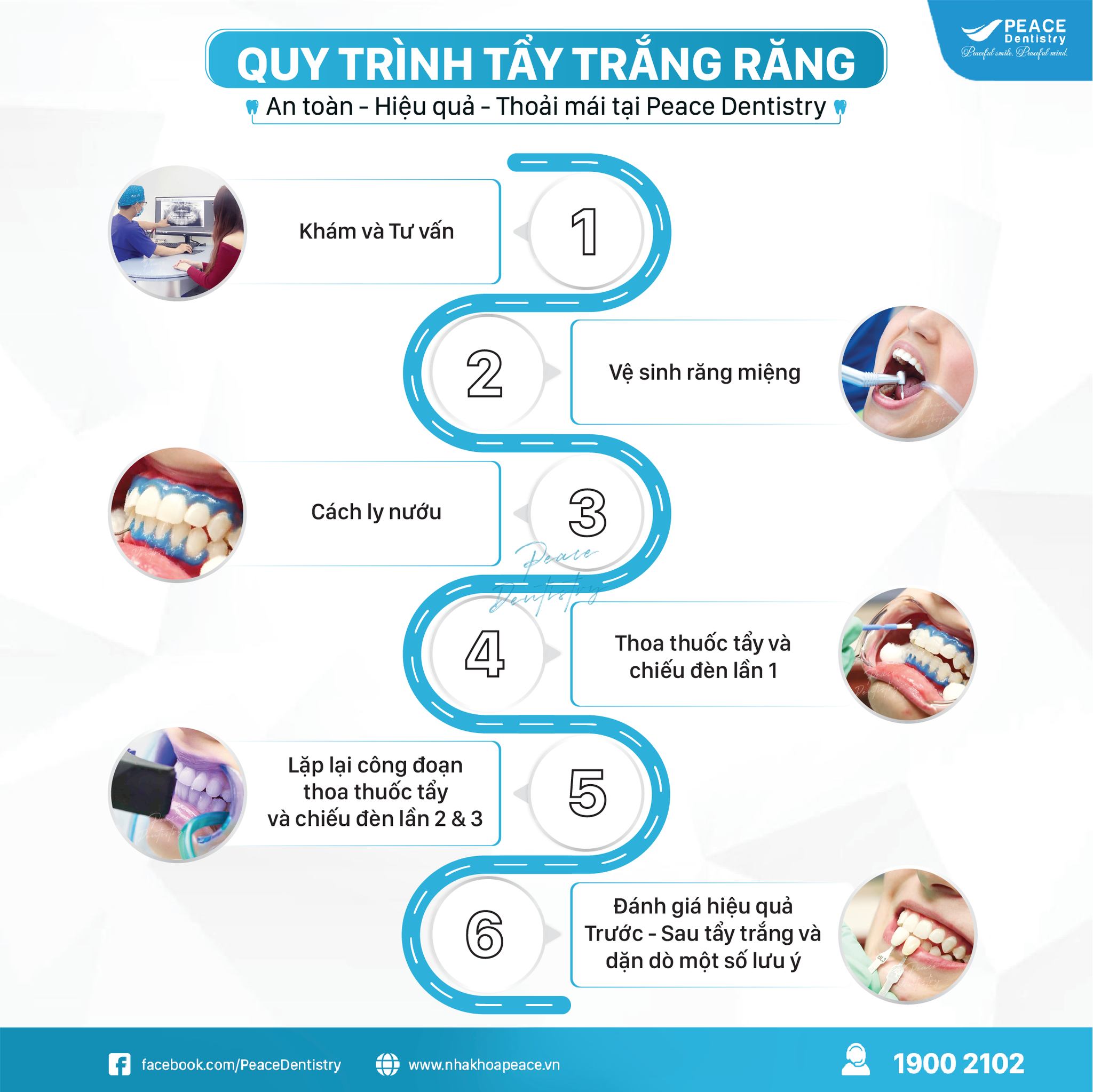 Quy trình tẩy trắng răng tại Peace Dentistry Quận 7