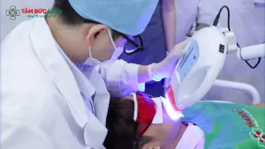 Tẩy trắng răng tại Nha khoa Tâm Đức Smile Quận 7