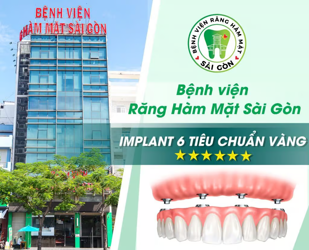 Răng Hàm Mặt Sài Gòn Thủ Đức - dịch vụ cấy ghép Implant